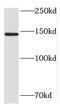 HDLBP antibody, FNab03812, FineTest, Western Blot image 