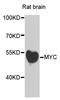 c-Myc antibody, A1309, ABclonal Technology, Western Blot image 