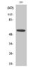 Cytochrome P450 Family 8 Subfamily B Member 1 antibody, A05518-1, Boster Biological Technology, Western Blot image 