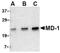 Lymphocyte Antigen 86 antibody, AP05223PU-N, Origene, Western Blot image 