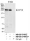 Kinesin Family Member 1B antibody, NB100-57494, Novus Biologicals, Immunoprecipitation image 