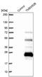 Transmembrane Protein 52B antibody, PA5-63525, Invitrogen Antibodies, Western Blot image 