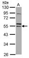Ring Finger Protein 14 antibody, LS-C155254, Lifespan Biosciences, Western Blot image 