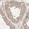 Deuterosome Assembly Protein 1 antibody, HPA010986, Atlas Antibodies, Immunohistochemistry paraffin image 