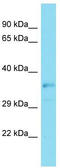 LIM Homeobox 9 antibody, TA342276, Origene, Western Blot image 