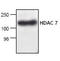 Histone Deacetylase 7 antibody, GTX21441, GeneTex, Western Blot image 