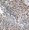 Splicing Factor 3a Subunit 3 antibody, FNab07776, FineTest, Immunohistochemistry paraffin image 
