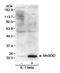 Superoxide Dismutase 2 antibody, A300-449A, Bethyl Labs, Western Blot image 