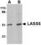 Ceramide Synthase 5 antibody, MBS150310, MyBioSource, Western Blot image 