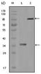 HCK Proto-Oncogene, Src Family Tyrosine Kinase antibody, AM06200SU-N, Origene, Western Blot image 