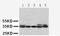 Cyclin Dependent Kinase 1 antibody, LS-C312708, Lifespan Biosciences, Western Blot image 