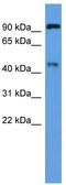 Endothelin-converting enzyme 2 antibody, TA335614, Origene, Western Blot image 