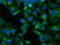 Nucleoredoxin Like 2 antibody, GTX83972, GeneTex, Immunocytochemistry image 