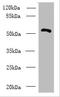 Zinc Finger And BTB Domain Containing 18 antibody, A61830-100, Epigentek, Western Blot image 