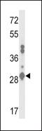 Glutathione S-transferase A2 antibody, PA5-26420, Invitrogen Antibodies, Western Blot image 