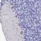 Potassium Two Pore Domain Channel Subfamily K Member 18 antibody, NBP1-81570, Novus Biologicals, Immunohistochemistry frozen image 