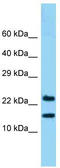 NADH:Ubiquinone Oxidoreductase Subunit B10 antibody, TA343253, Origene, Western Blot image 