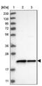 2'-Deoxynucleoside 5'-Phosphate N-Hydrolase 1 antibody, NBP1-85180, Novus Biologicals, Western Blot image 