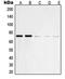 Protein Tyrosine Phosphatase Non-Receptor Type 11 antibody, orb214482, Biorbyt, Western Blot image 