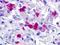 Gonadotropin-releasing hormone receptor antibody, NLS209, Novus Biologicals, Immunohistochemistry paraffin image 