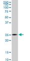 Zinc Finger HIT-Type Containing 3 antibody, H00009326-M09, Novus Biologicals, Western Blot image 