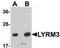 NADH:Ubiquinone Oxidoreductase Subunit B9 antibody, TA306948, Origene, Western Blot image 