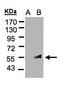 Feline Leukemia Virus Subgroup C Cellular Receptor 1 antibody, GTX106462, GeneTex, Western Blot image 
