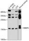 RB Binding Protein 9, Serine Hydrolase antibody, 19-377, ProSci, Western Blot image 