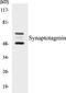 Synaptotagmin 1 antibody, EKC1556, Boster Biological Technology, Western Blot image 