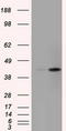 Sterol O-acyltransferase 2 antibody, CF501225, Origene, Western Blot image 