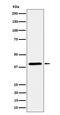 ADH4 antibody, M04620, Boster Biological Technology, Western Blot image 