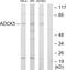 AarF Domain Containing Kinase 5 antibody, LS-C119090, Lifespan Biosciences, Western Blot image 