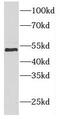 p50 dynamitin antibody, FNab02579, FineTest, Western Blot image 