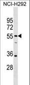 Spermatogenesis Associated 21 antibody, LS-C157071, Lifespan Biosciences, Western Blot image 