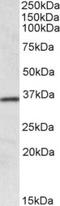 Homeobox protein Hox-A4 antibody, TA311222, Origene, Western Blot image 