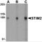 Stromal Interaction Molecule 2 antibody, 4125, ProSci, Western Blot image 