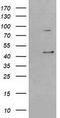 Serpin B3 antibody, CF502259, Origene, Western Blot image 
