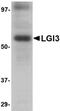 Leucine-rich repeat LGI family member 3 antibody, NBP1-76383, Novus Biologicals, Western Blot image 
