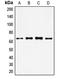 Forkhead Box O4 antibody, LS-C352514, Lifespan Biosciences, Western Blot image 