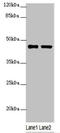 SH3 Domain Containing GRB2 Like 1, Endophilin A2 antibody, LS-C676478, Lifespan Biosciences, Western Blot image 