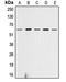 Akt antibody, orb213538, Biorbyt, Western Blot image 