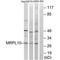 Mitochondrial Ribosomal Protein L10 antibody, PA5-49936, Invitrogen Antibodies, Western Blot image 