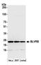 Biliverdin Reductase B antibody, A305-570A, Bethyl Labs, Western Blot image 