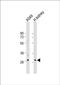 Poly(A) Binding Protein Nuclear 1 Like, Cytoplasmic antibody, PA5-48309, Invitrogen Antibodies, Western Blot image 