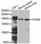 CD11b antibody, A1581, ABclonal Technology, Western Blot image 