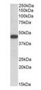 Stromal Cell Derived Factor 4 antibody, orb22530, Biorbyt, Western Blot image 