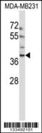 EMI Domain Containing 1 antibody, 57-087, ProSci, Western Blot image 