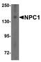 NPC Intracellular Cholesterol Transporter 1 antibody, A00428, Boster Biological Technology, Western Blot image 