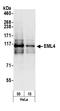 Echinoderm microtubule-associated protein-like 4 antibody, A301-908A, Bethyl Labs, Western Blot image 