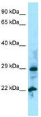 NUDT5 antibody, TA338097, Origene, Western Blot image 